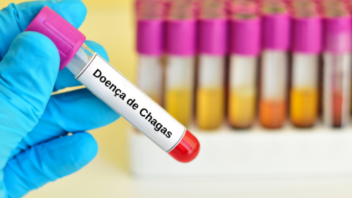 Doença de Chagas
